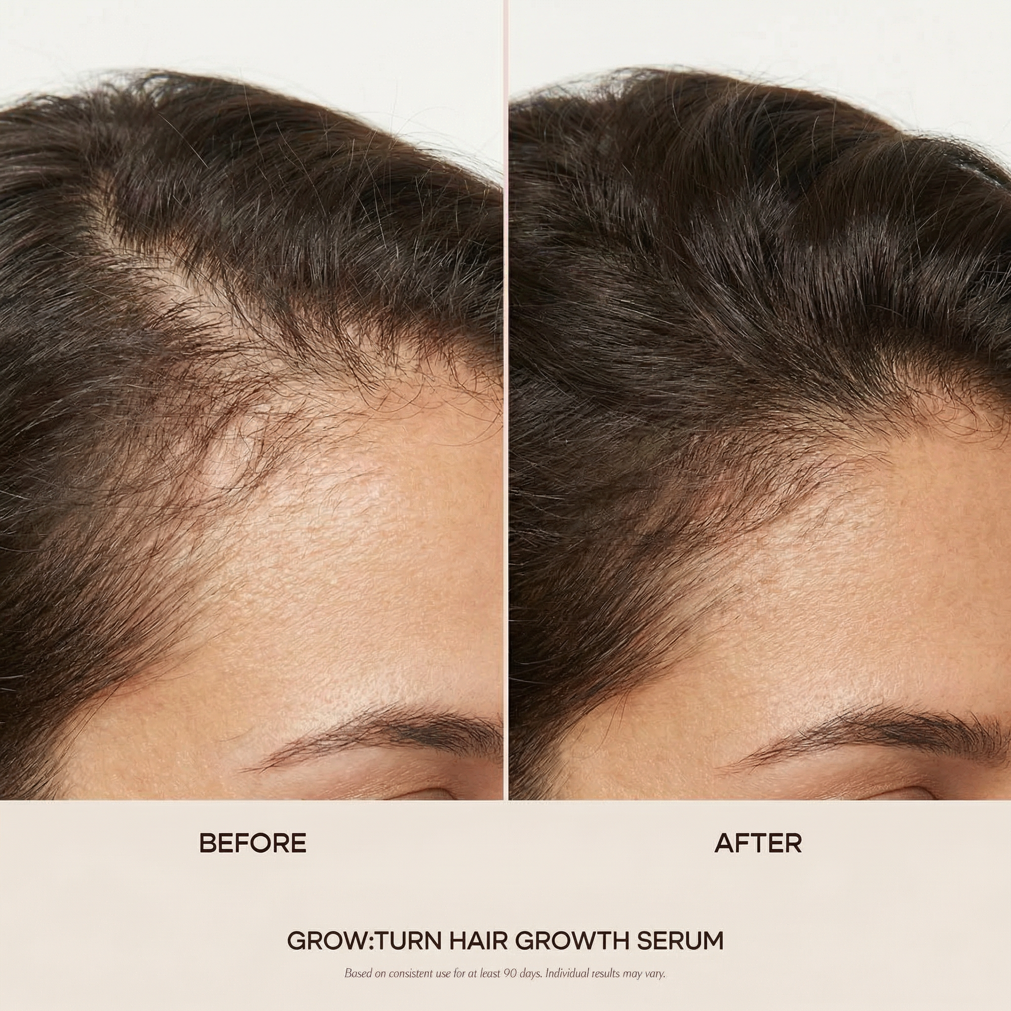 GYEOL Grow: Turn Hair Growth Serum